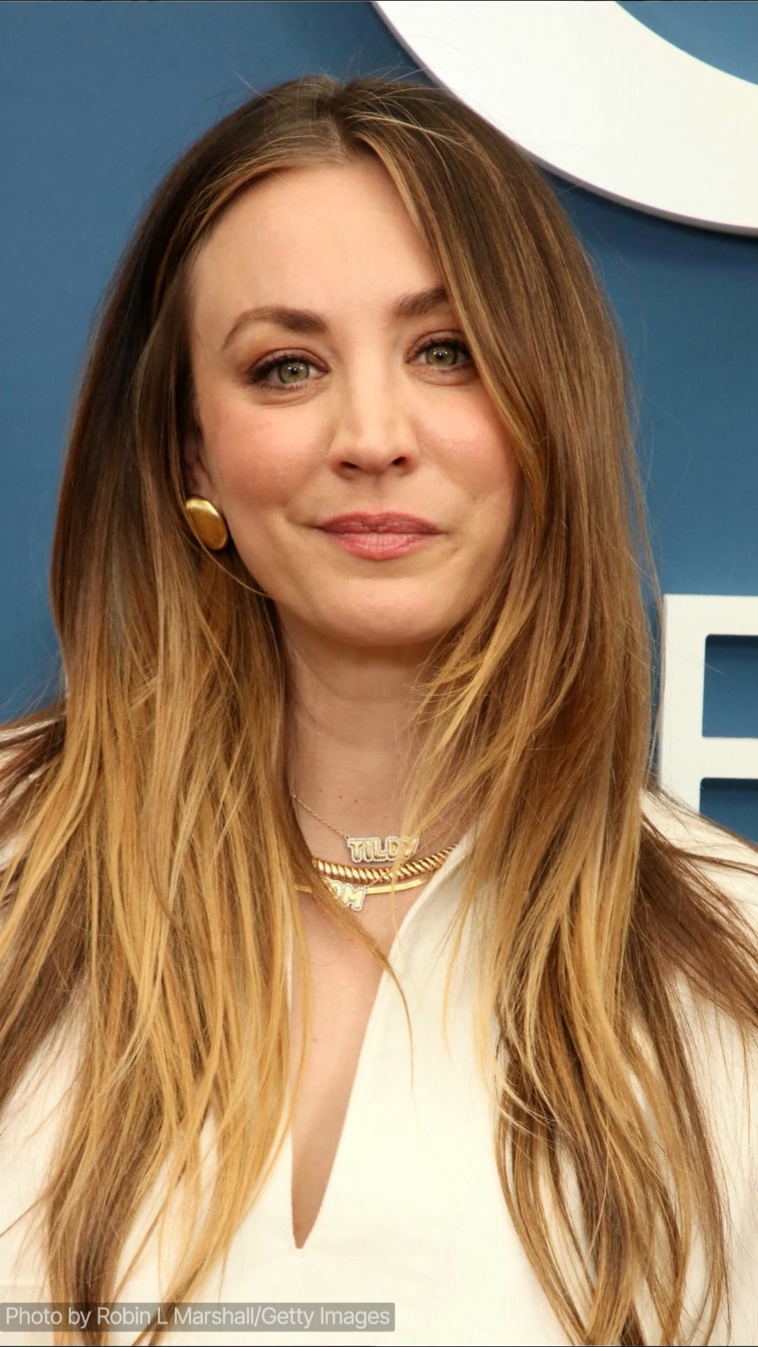 Celebridades Que Se Arrepienten De Haberse Sometido A Cirugía Plástica…